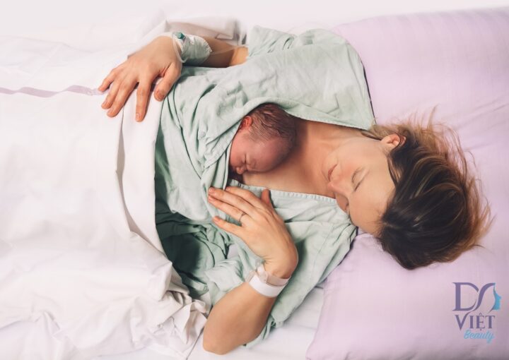 Chăm Sóc Da Nám ở Phụ Nữ Sau Khi Sinh