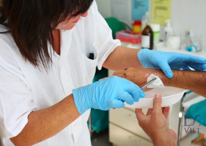 Chăm Sóc Vết Thương: Quá Trình Lành và Phân Loại Vết Thương