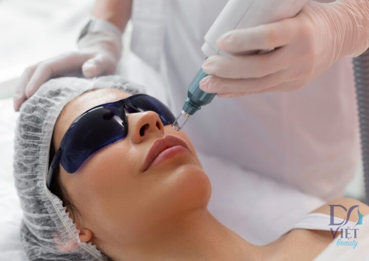 Rậm lông vùng mặt: cách xử lý & lưu ý