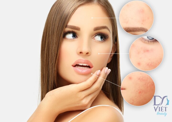 Khám Phá Về Các Dạng Sẹo Thường Gặp: Hiểu Rõ Và Đối Phó