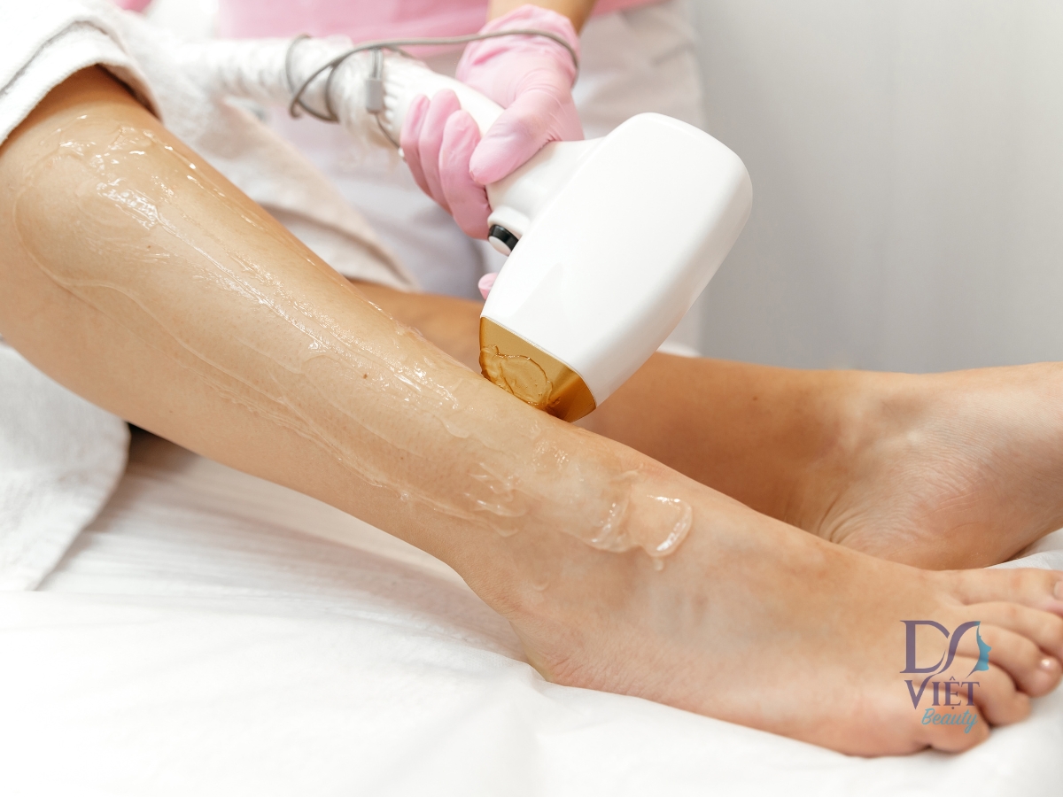 Sự khác biệt giữa các máy laser