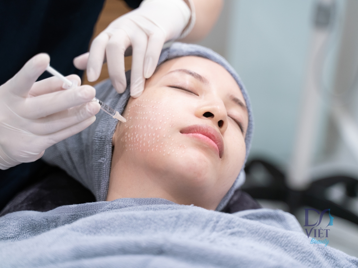 Mesotherapy trong điều trị tăng sắc tố da