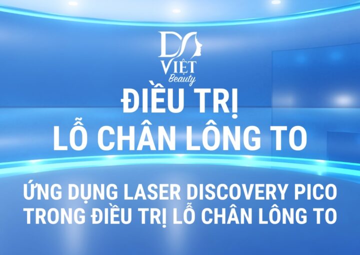 Lỗ chân lông to - Ứng dụng Laser Discovery PICO trong điều trị Lỗ chân lông to