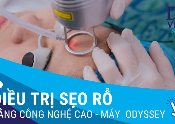 Điều trị SẸO RỖ tại DA VIỆT BEAUTY bằng công nghệ cao, máy ODYSSEY