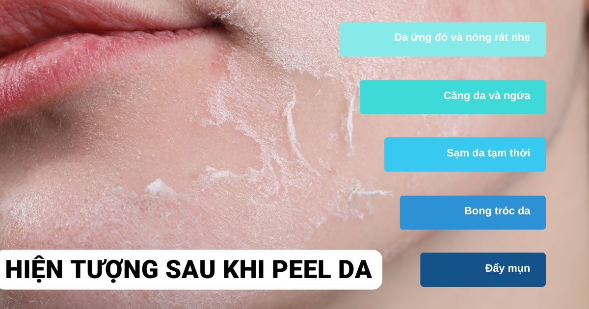 Hiện tượng sau khi peel da