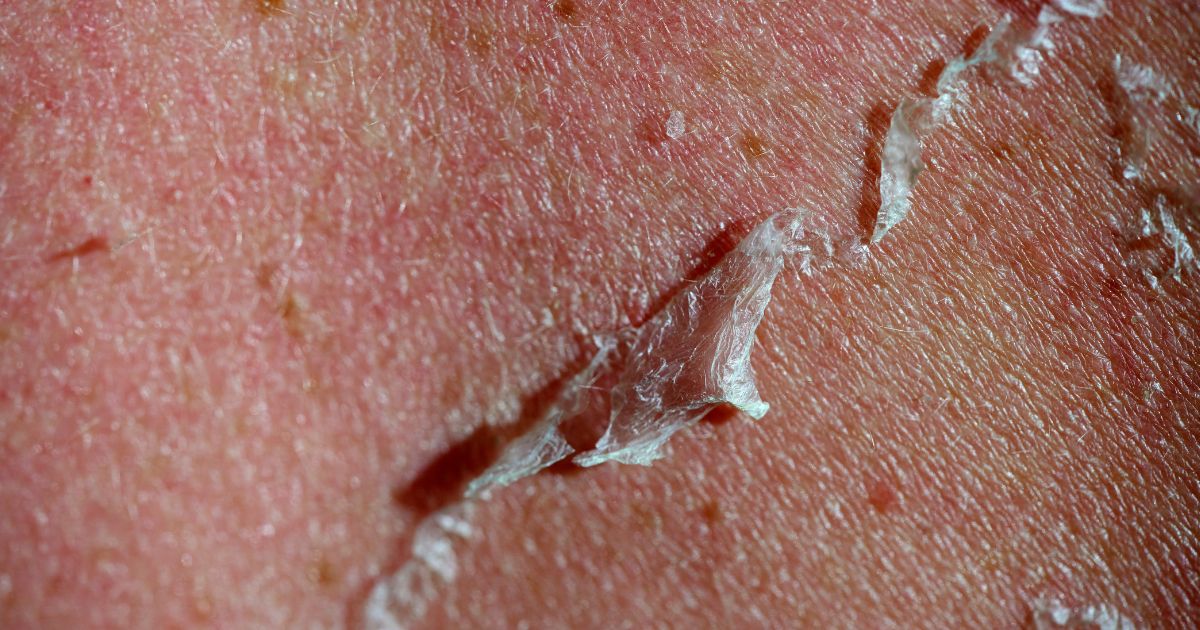 cơ chế của pee da