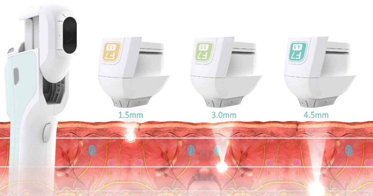 Cơ chế hoạt động của công nghệ hifu