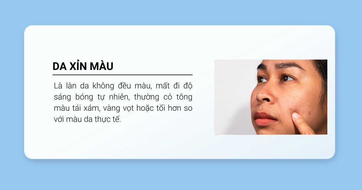 Da xỉn màu định nghĩa là gì