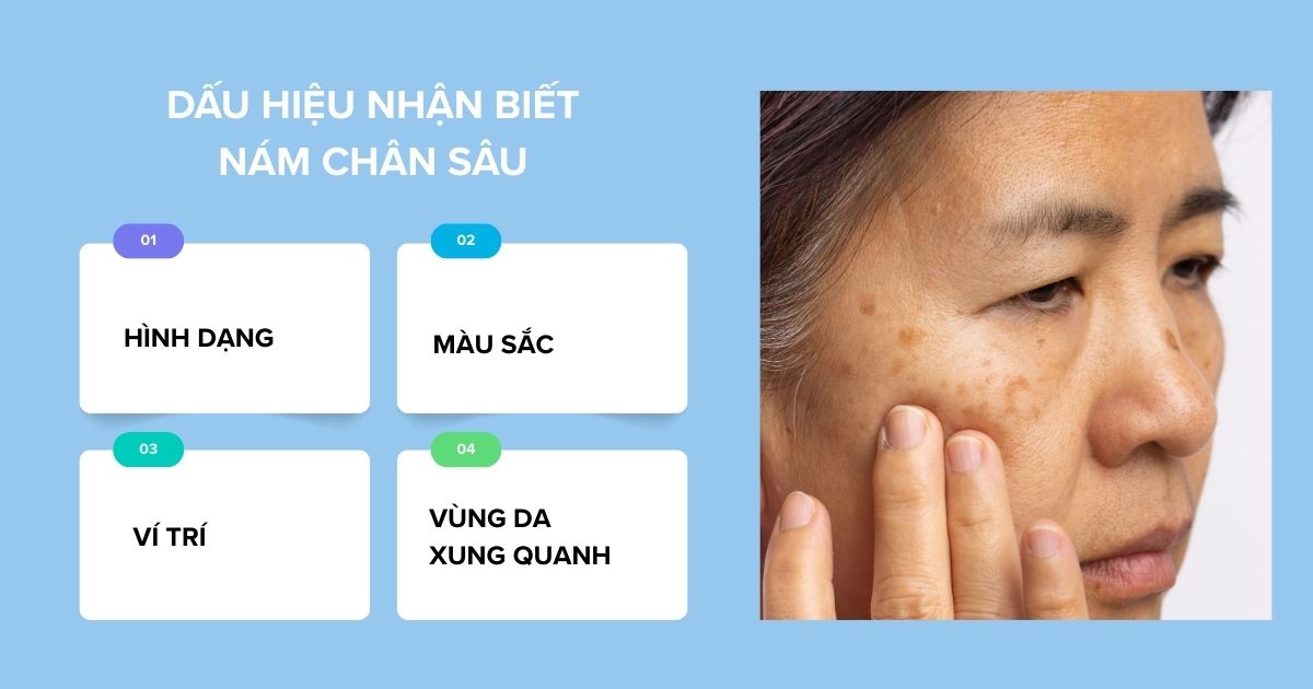 Dấu hiệu nhận biết nám chân sâu