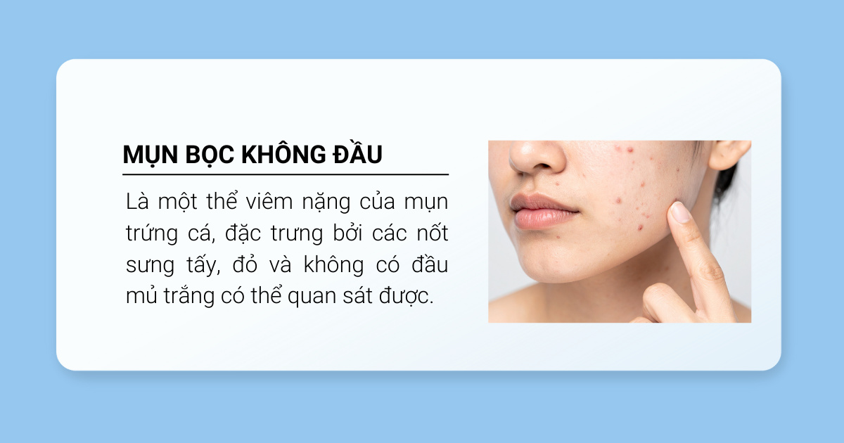 Định nghĩa mụn bọc không đầu 