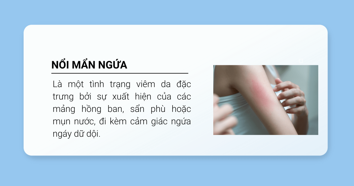 nổi mẩn ngứa là gì 