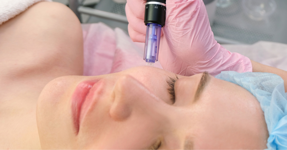 4 yếu tố ảnh hưởng đến thời gian tiêm meso bao lâu thì đẹp